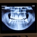 연세밝은아이치과의원 | 갑자기 치과 갈 일 생기면, 내비 켜고 달려가야 하는 곳