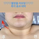 피부맑음 이미지