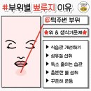 부위별 뾰루지 나는 이유~ 이미지