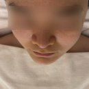 위드미 수원광교점 | 수원 광교 피부관리 블랙헤드 관리와 데콜테를 한번에 받을 수 있는 ‘프롬미 수원광교점’ 솔직후기