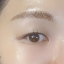 당산피부과 스킨부스터 쥬베룩아이 내돈내산 후기 가격 통증 효과 부작용 결절까지