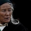 해운대초교 | 이마 라인 광채 여기가 찐이다! 그레이스 피부과 드디어 상륙 후기