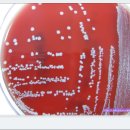 BAP(Staphylococcus epidermidis)의 성상 이미지