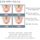 황금주걱 플러스 이미지