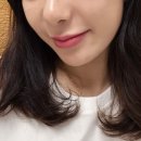 NO.1 자동차피부과 | [홍대입구역 피부과 추천] 자연스러운입술필러 맛집 가로확장입술필러로 얼굴 비율까지 바뀐 내돈내산 후기