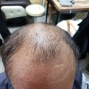 모앤모명품가발 | 순천가발 자연스럽게 잘하는곳 모앤모명품가발