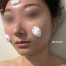 디엘르테라피