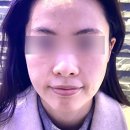 이수역 방배피부관리 스파루체 얼굴윤곽관리 후기