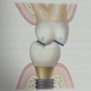 마모이룸 이미지