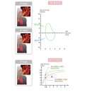 숨결소락 곰보배추즙 아버지 폐렴 기침 후기
