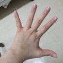 #01 백혈병의 성지로 갈까요 (서울성모병원으로 옮겻다는뜻)