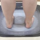 발올림 이미지