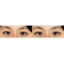 정바른자세연구소 안면비대칭 경락 마사지 치료 내돈내산