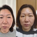 더업그레이드