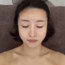 경기하이퍼 | [양주 에스테틱] 윤메디테라피 하이퍼소닉 콜라겐·V라인·승모근 관리 솔직후기