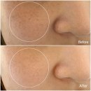 세미 스킨케어(Semi skin care) | [연남동뷰티샵/연남동채움뷰티]✨ 연남동 채움뷰티리뷰 감사 이벤트 안내 ✨