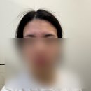 인천논현동왁싱 하나앤왁싱에서 헤어라인 저자극으로 받은 후기