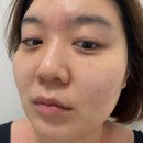 트로이온 | 트로이아르케 에스테틱 피부정검하고 트로이필 스피큘 관리 받고 온 후기