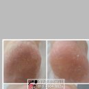 레푸스죽전새터점