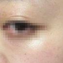티엑스엑스 이미지