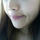 하예치과의원 | [뉴욕연세치과] 앞니치아성형 + 치아미백 시술후기_이**님 (시크릿라미네이트/줌미백)