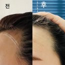 타스헤어 티스토리