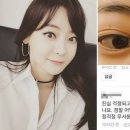 '눈 앞트임 성형 의혹'에 자신의 희귀병 고백한 서유리 이미지