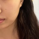 하대동303 | [진주 피부관리] 하대동 피부관리샵 아다한 스킨부스터 후기