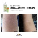 토픽피부관리실