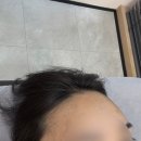 송도 슈가링왁싱 아망뜨, 헤어라인왁싱 후기