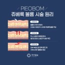 볼륨2 네이버블로그