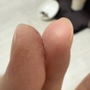 목욕하는 고양이 | 고양이링웜 곰팡이성 피부염 완치 후기 증상부터 치료까지 3달간의 기록