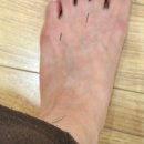 7277 | 사암당한의원 은평점 한달 진료 후기