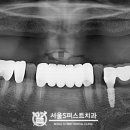 서울에스(S)퍼스트치과의원 이미지