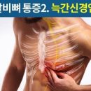 오른쪽 갈비뼈 아래 통증 원인 5가지 및 이미지