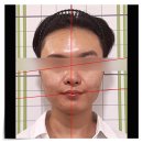 신중 | 안면비대칭교정후기 신중하게 고려해야