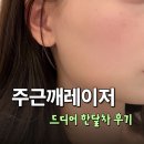 일산 주근깨 제거 루비레이저 한달차 후기, 얼마나 만족할까?