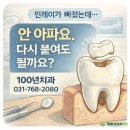 이재치과의원 | 인레이가 빠졌는데 안 아파요, 그냥 다시 붙이면 될까요? 재부착 증례