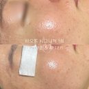 무리바 케어 이미지