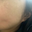 헤나 헤어샾 - 영광군 | 헤나염색 부작용 릴흑피증 릴흑색증 얼굴 검은 반점들 기미아님