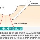 금송아지한의원 네이버블로그