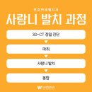 연세이지치과의원 네이버블로그