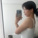 블리핏 | 인천구월피부과 블리핏 팔뚝지방분해주사 100cc 내돈내산 4회차 후기
