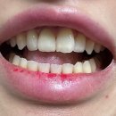 삼성현치과의원 | 봉천역 임플란트 전문 치과 잘하는 곳 List 추천 6곳