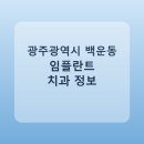 광주광역시 백운동 임플란트 병원 찾는다면, 가격표와 후기 먼저 보기