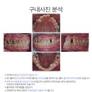 스타일치과기공소 네이버블로그