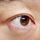 정영주안과의원 이미지