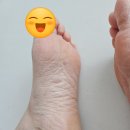 이블링 | 극혐주의) 발각질 제거제 룸이블링 만족 _ 부작용 발바닥 따끔함.
