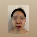 일산 백석역 근처 에스테틱쉬작 : 얼굴 비대칭 &amp; 얼굴윤곽관리 리얼 후기