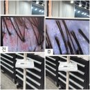 수원-1604 | 수원두피관리 이씨바버샵에서 모발생장술 30대 가늘어진 모발관리